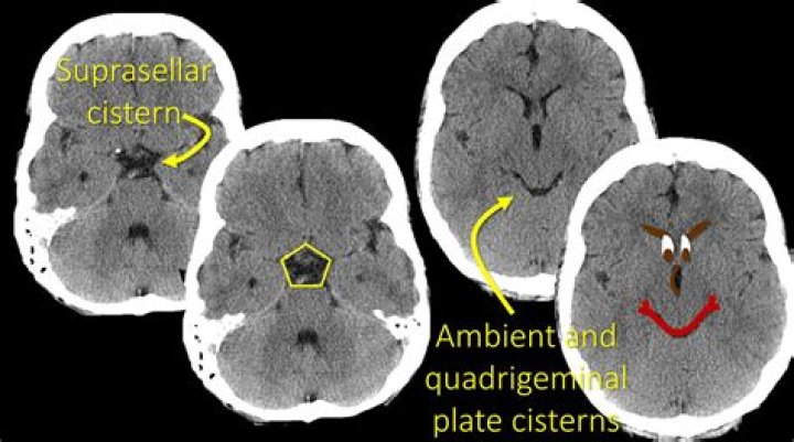 Are cisterns illegal?