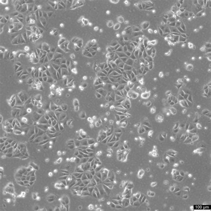 Are MCF-7 cells triple negative?