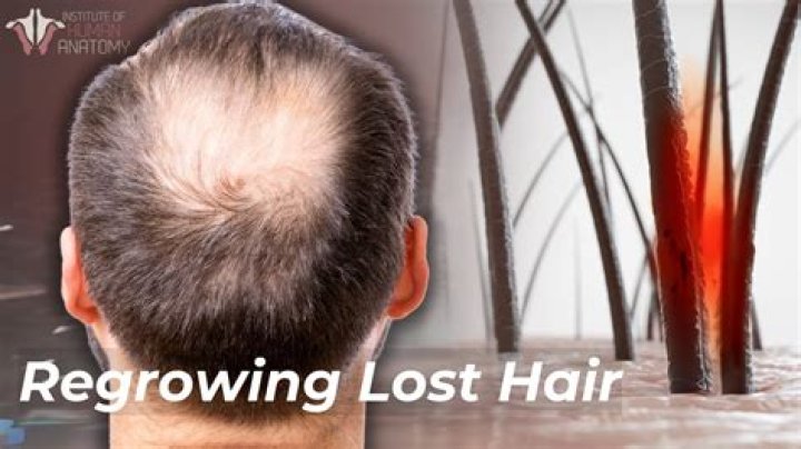 Can onion regrow lost hair?