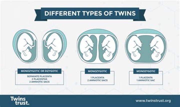 Can twins be attached to each other?