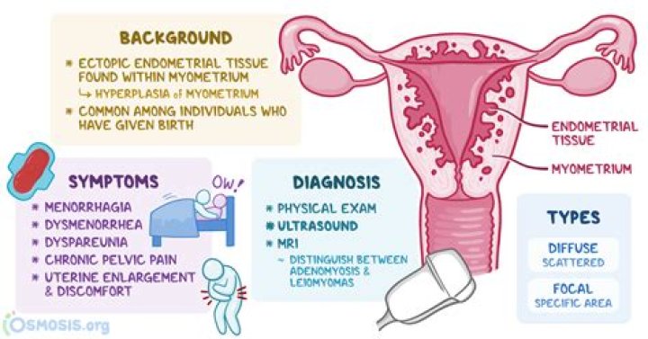 Does adenomyosis cause enlarged uterus?