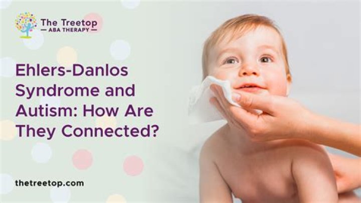 How do I know if my child has Ehlers-Danlos Syndrome?