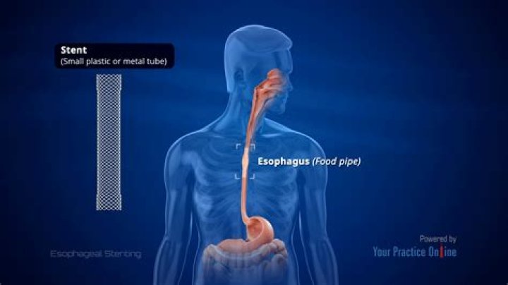 How do you check your esophagus?