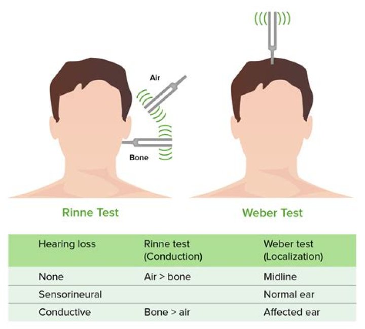 How do you read Rinne and Weber test?