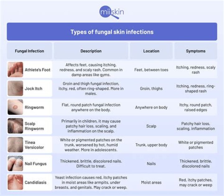 How do you treat skin fungus on your back?