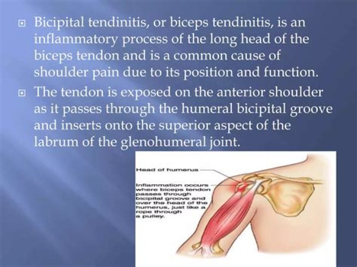 How is Bicipital tendonitis diagnosed?