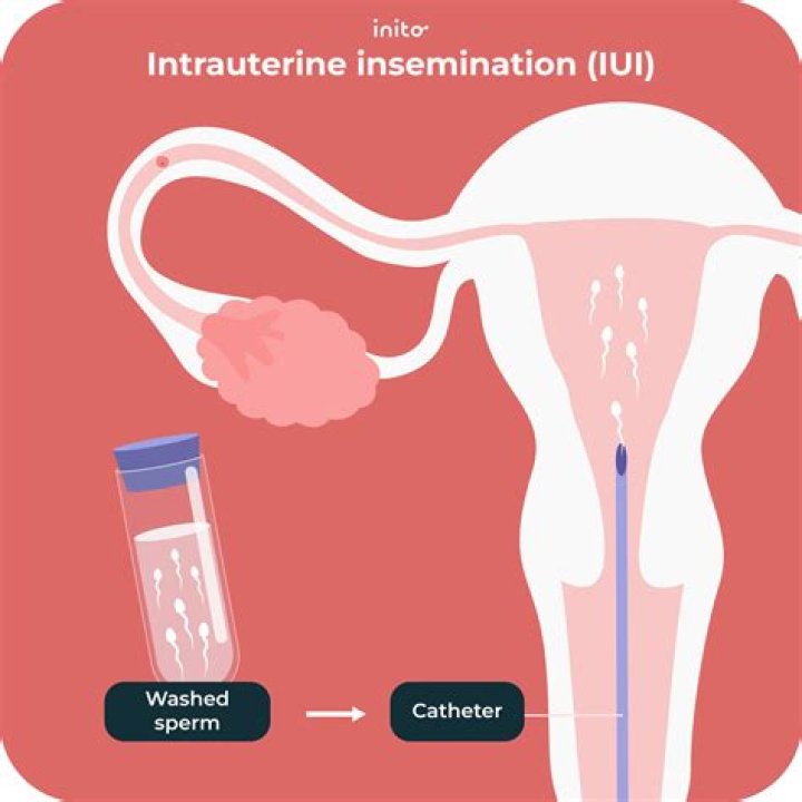 How much does IUI cost in Denmark?