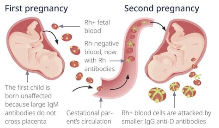 Is anti-D given in every pregnancy?