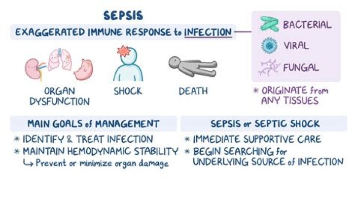 Is sepsis always the principal diagnosis?
