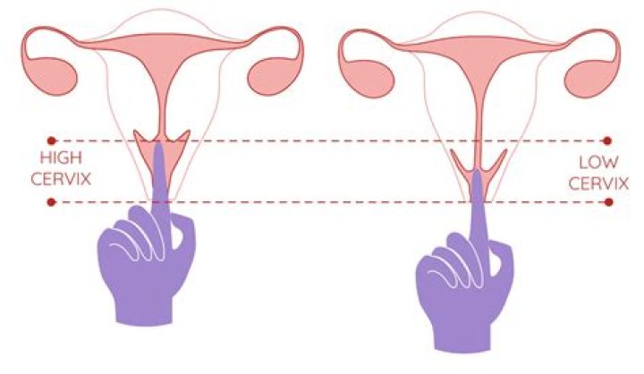 Is your cervix high during implantation?