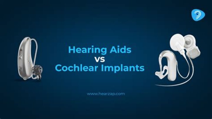 What are the criteria for getting a cochlear implant?
