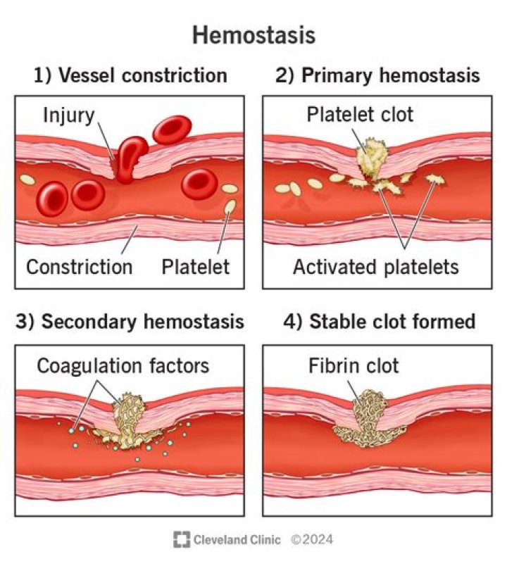What are the general pathways of hemostasis blood clotting?