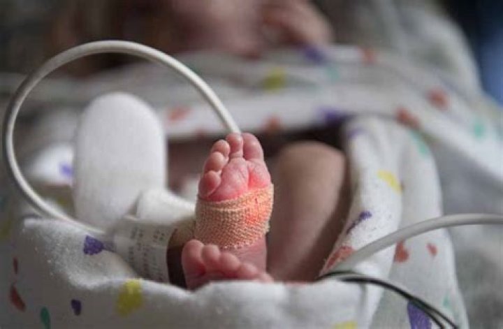 What are the typical findings in newborns with gastroschisis?