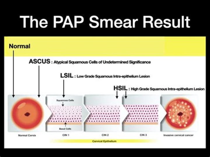 What does it mean if endometrial cells are found in a Pap smear?
