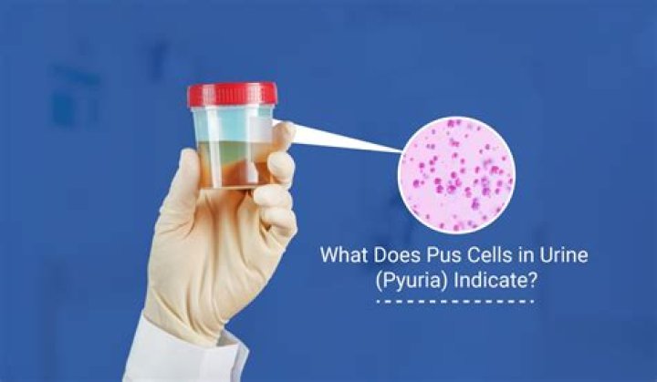 What does pus in urine look like?