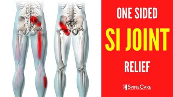 What does sacroiliac pain feel like?