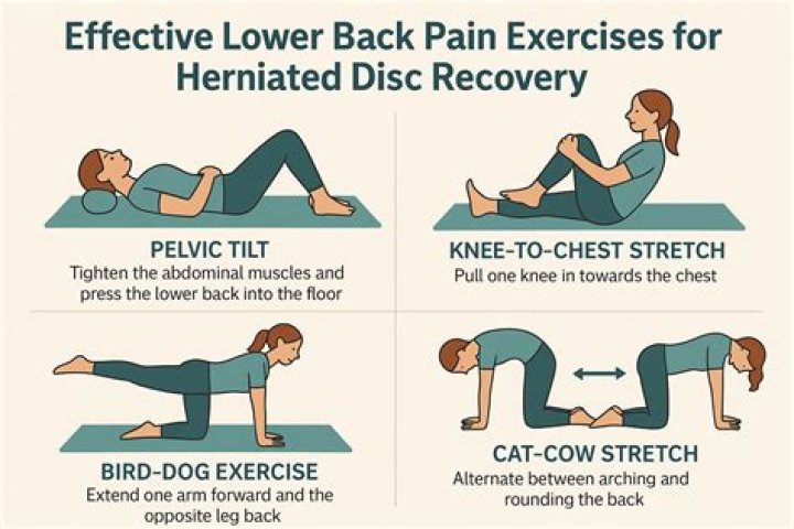 What exercise is good for slipped disc?