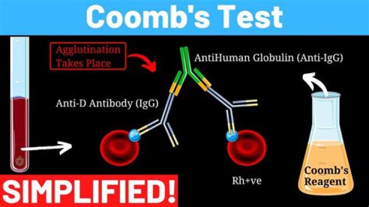 What if my Coombs test is positive?