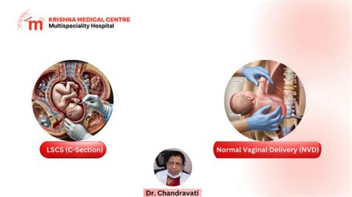 What is a LSCS delivery?