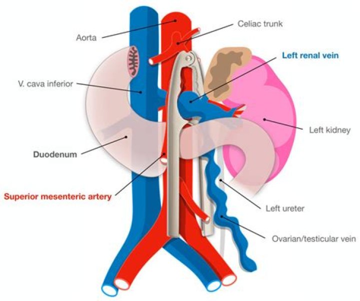 What is a mesenteric duplication cyst?
