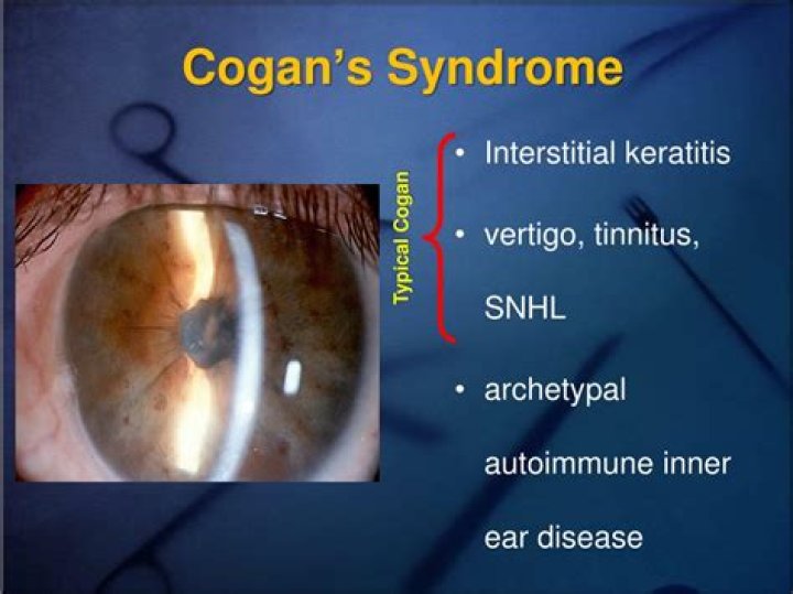 What is Cogans syndrome?