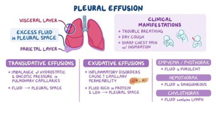 What is diffusion and effusion in chemistry?