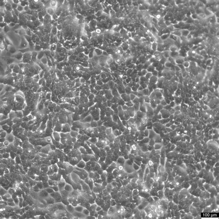 What is HCT 116 cell line?