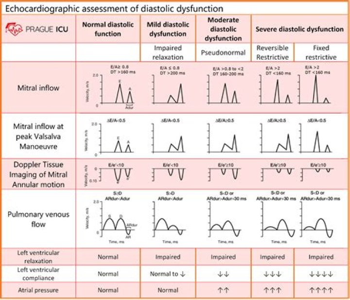 What is LV end diastolic dimension?
