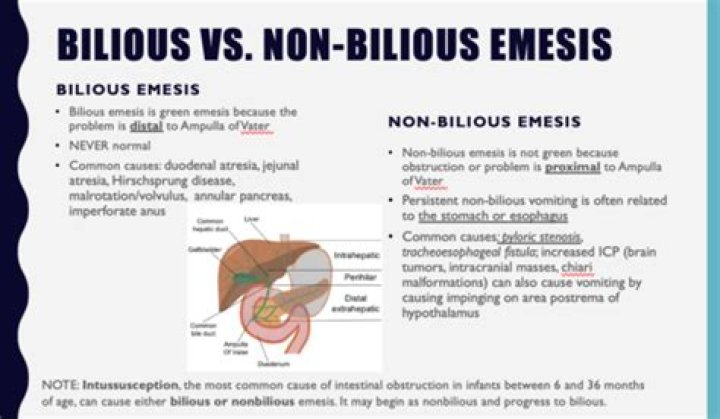 What is Nonbilious?
