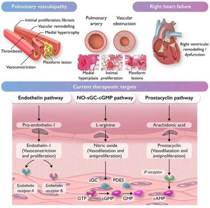What is pathophysiology of cervical cancer?