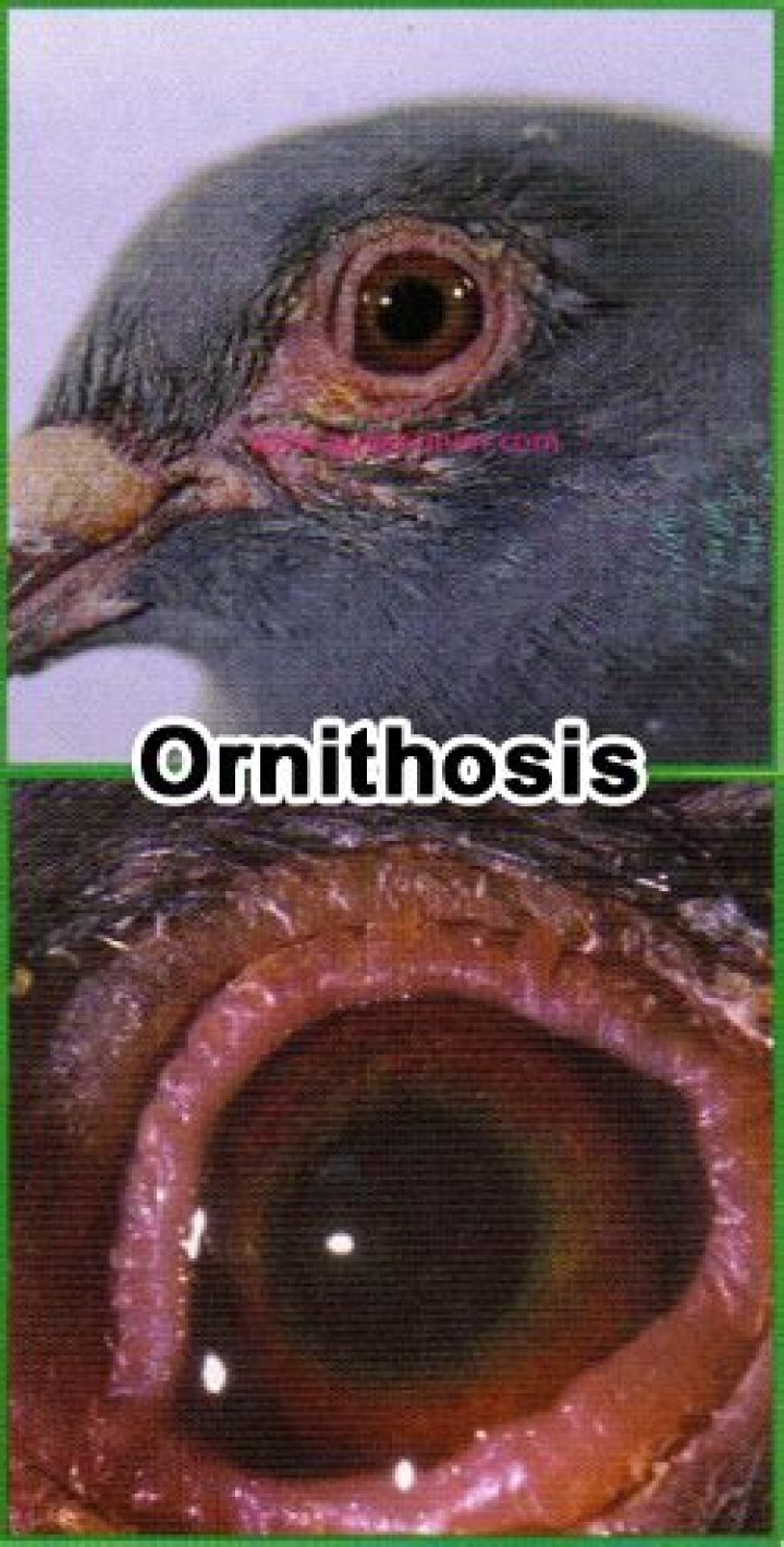 What is Pigeon ornithosis?