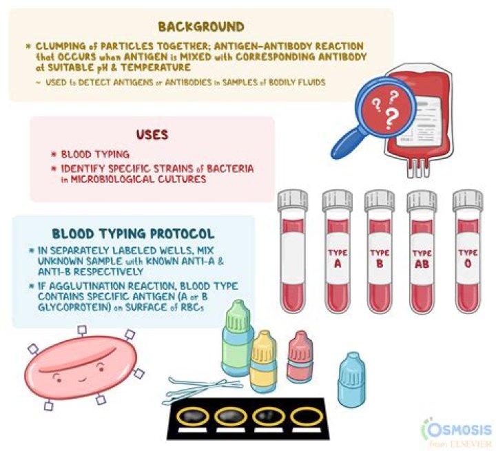 What is the blood test for Listeria?