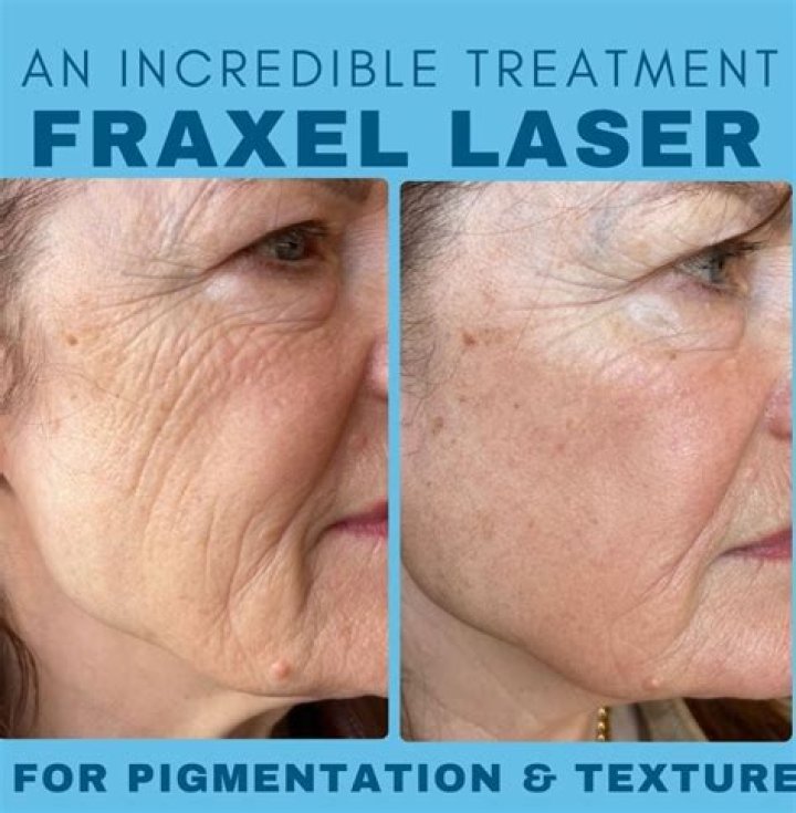 What is the difference between Fraxel DUAL and Fraxel repair?