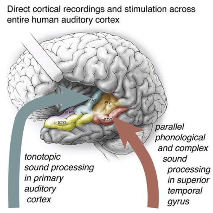 What is the meaning of auditory perception?