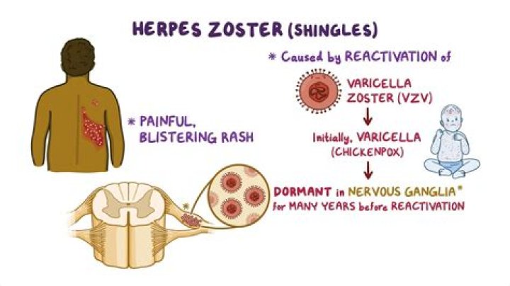 What is the mode of transmission of herpes?
