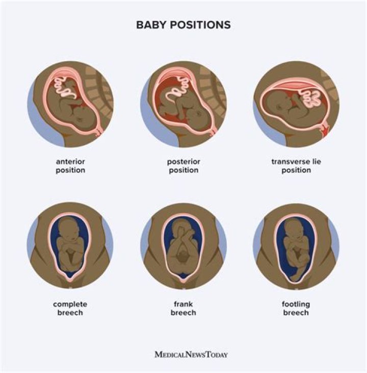 What is the position of twins during pregnancy?