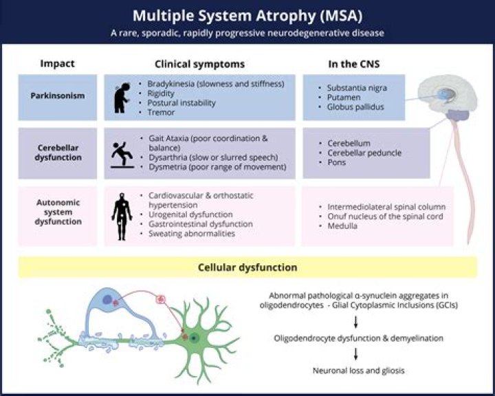 What is the progression of MSA?