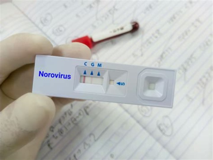 What is the test for norovirus?