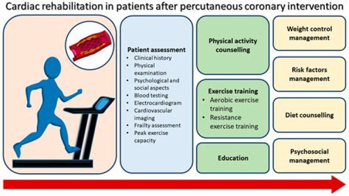 When should CABG be done?