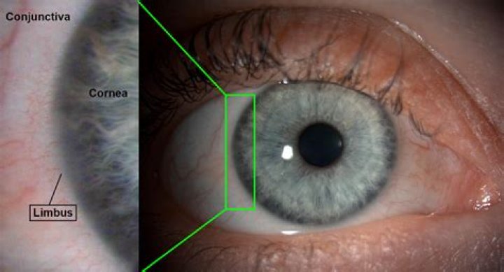 Where is the corneal limbus?