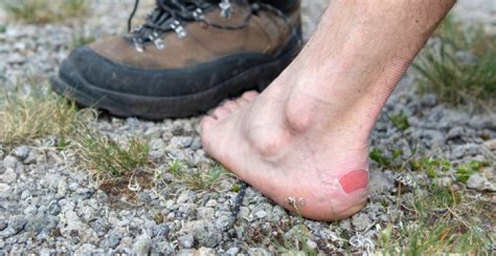 Why do I get blisters on my toes when I hike?