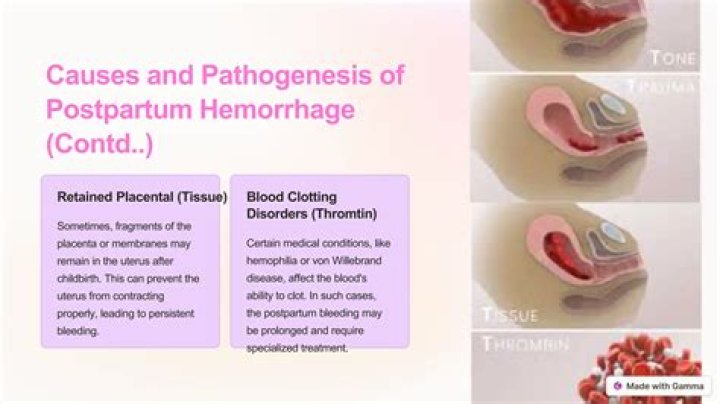 Why does postpartum hemorrhage occur in cases of uterine subinvolution?